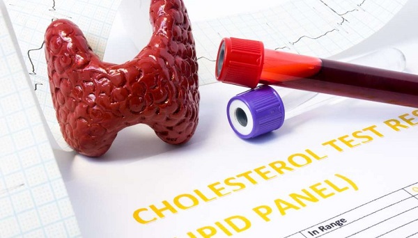 Model of thyroid gland, test tubes with blood for lipids diagnosis and clinical laboratory analysis results for cholesterol placed on the white table.